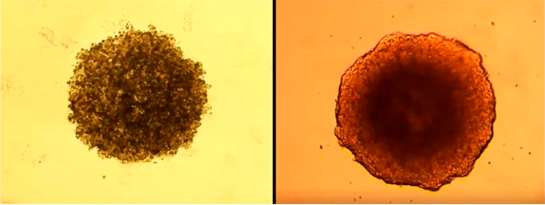体外构建高仿真肿瘤，AI自动分析转移能力丨专访东大医械院陈早早