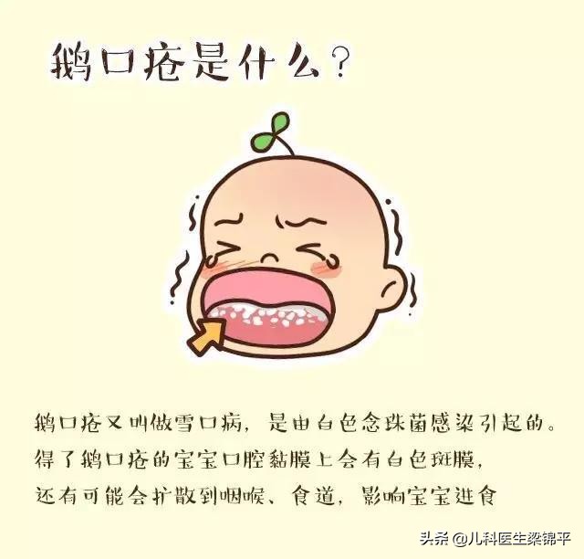 孩子嘴里有一层白膜，其实是鹅口疮，教你几招搞定无烦恼