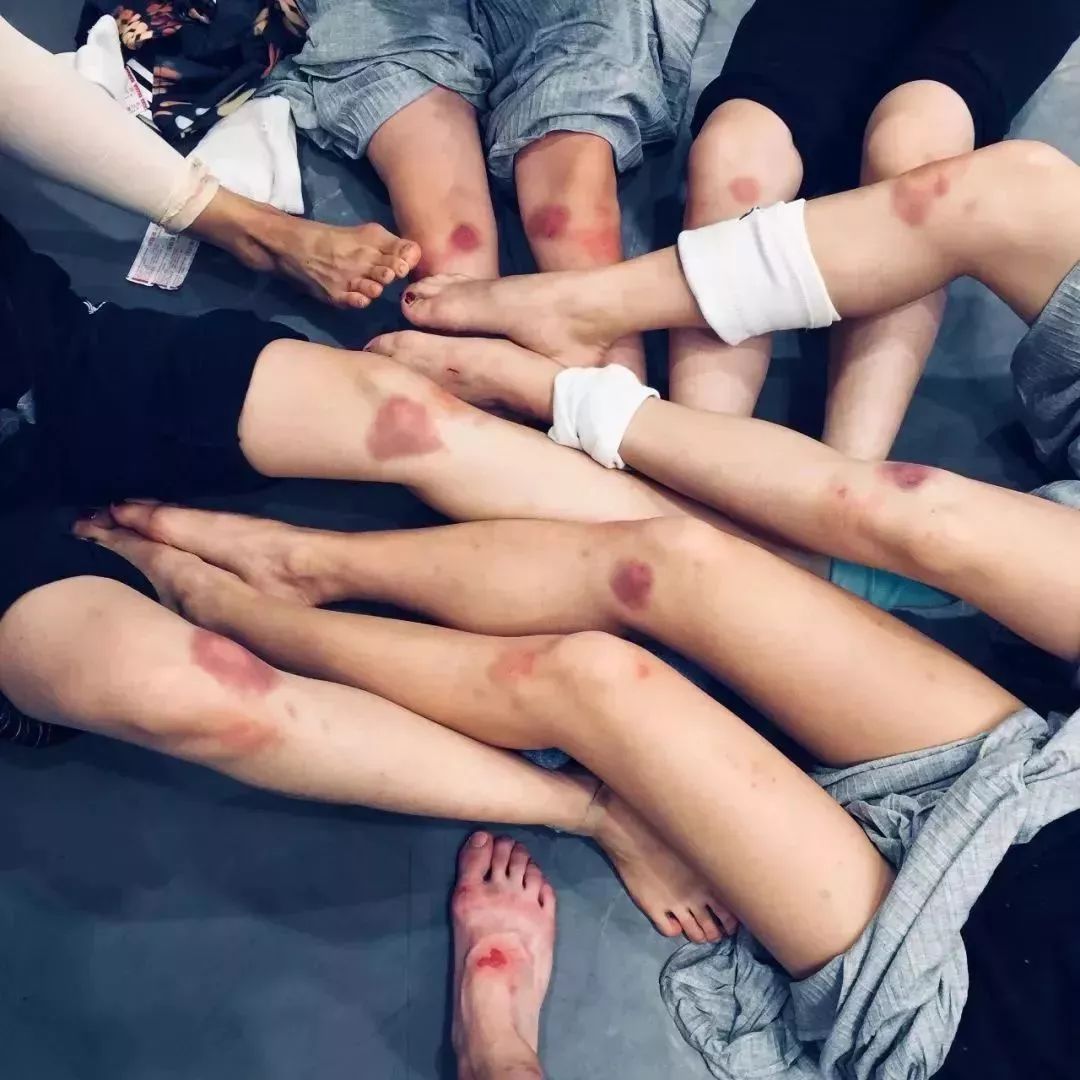 有一种痛叫舞蹈艺考生肌肉撕裂的痛,你还敢报考吗?