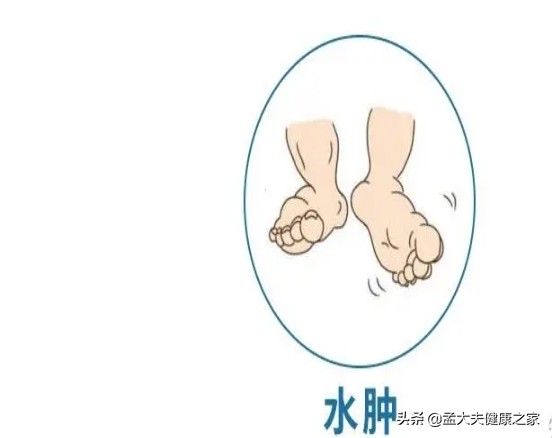 食物嘌呤表：尿酸高什么能吃什么不能吃？看这一篇就够了