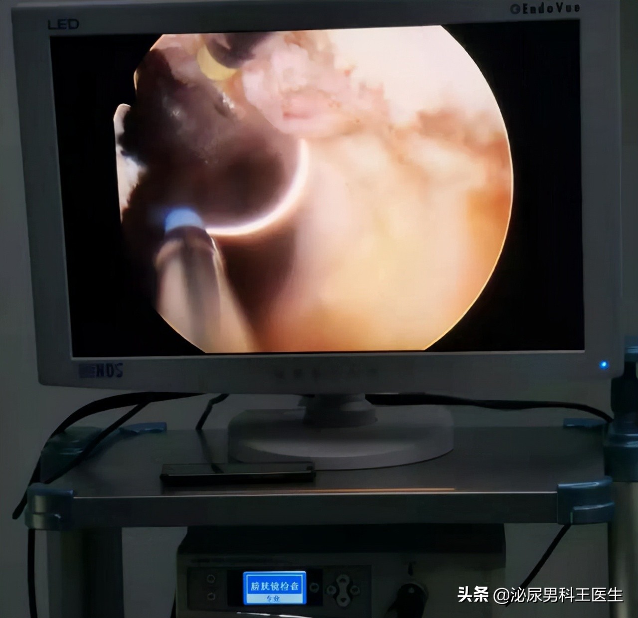 中老年人得了前列腺增生应该怎么办？