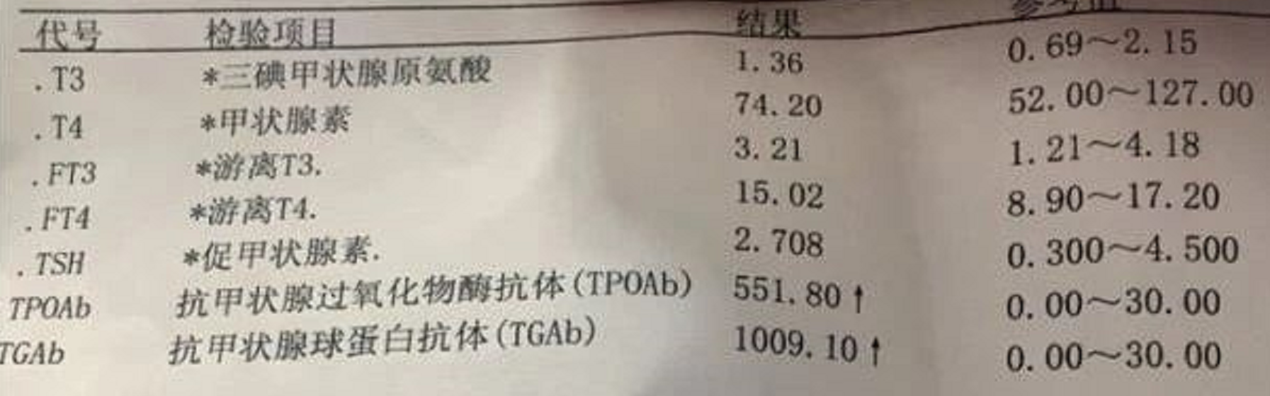 甲状腺功能报告单，看哪几项指标确定桥本甲状腺炎？大夫教你