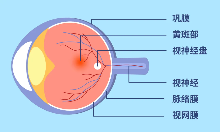包括视网膜,黄斑,脉络膜和视神经等眼底,是指眼球内后部的组织什么是