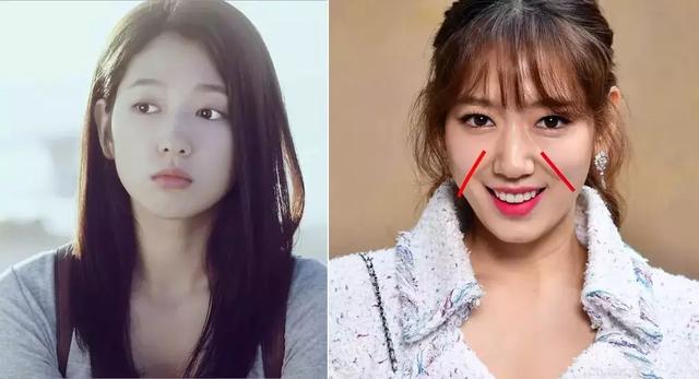 鼻子两侧八字纹很深怎么消除(让.女人夜夜疯狂的神器)