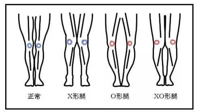 三步方法，循序渐进，助你摆脱各种
