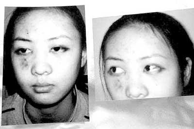 “小章子怡”：为上位被教授强奸，被张国立儿子家暴报复险些丧命