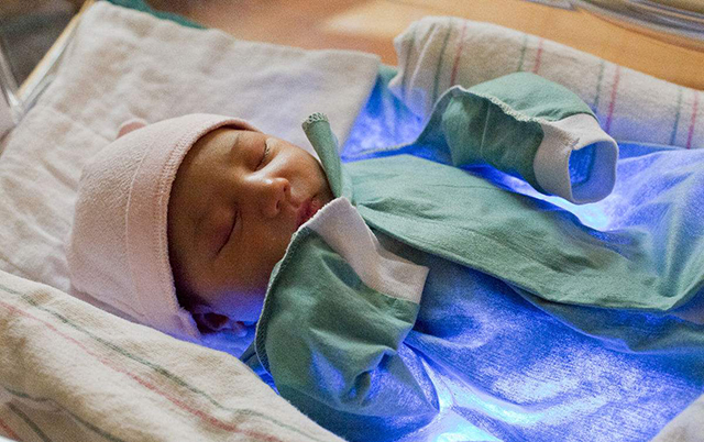 十个婴儿九个黄，都要住院照蓝光，新生儿黄疸有那么可怕？