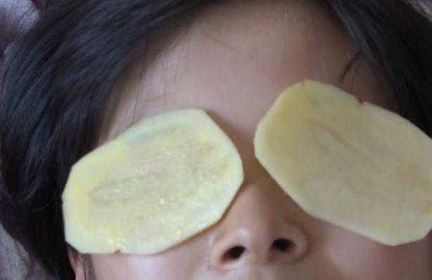 土豆除了能吃之外还有这几个用途