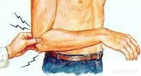 胳膊肘疼不能提重物拧毛巾？骨科医生告诉你有了「网球肘」怎么办