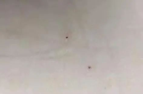 红黄蓝“换马甲”又虐童?每月学费1万2,老师针扎孩子被家长报警