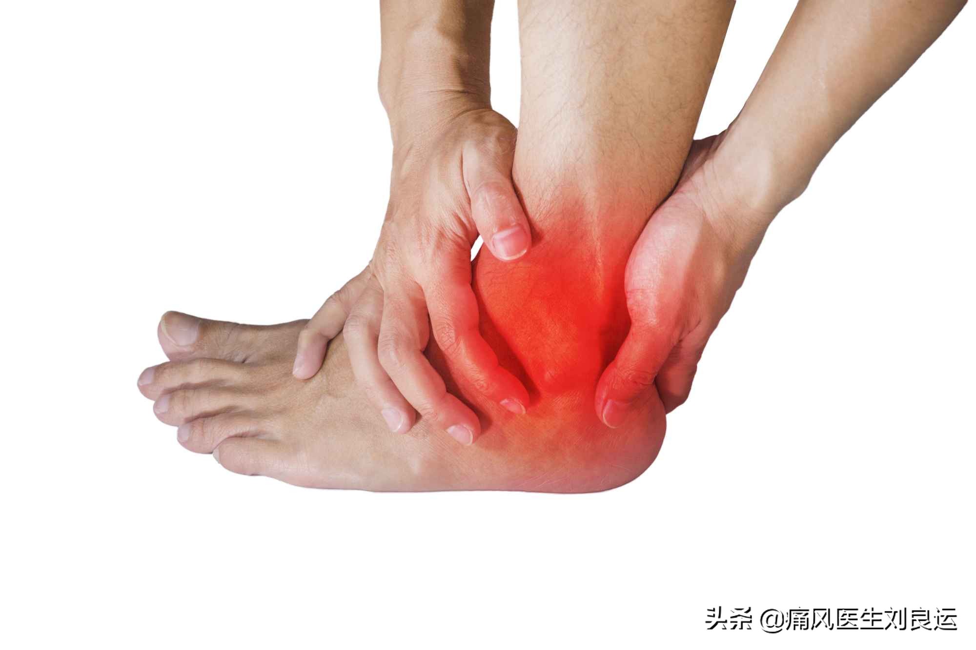 痛风反复发作的原因及判断方法