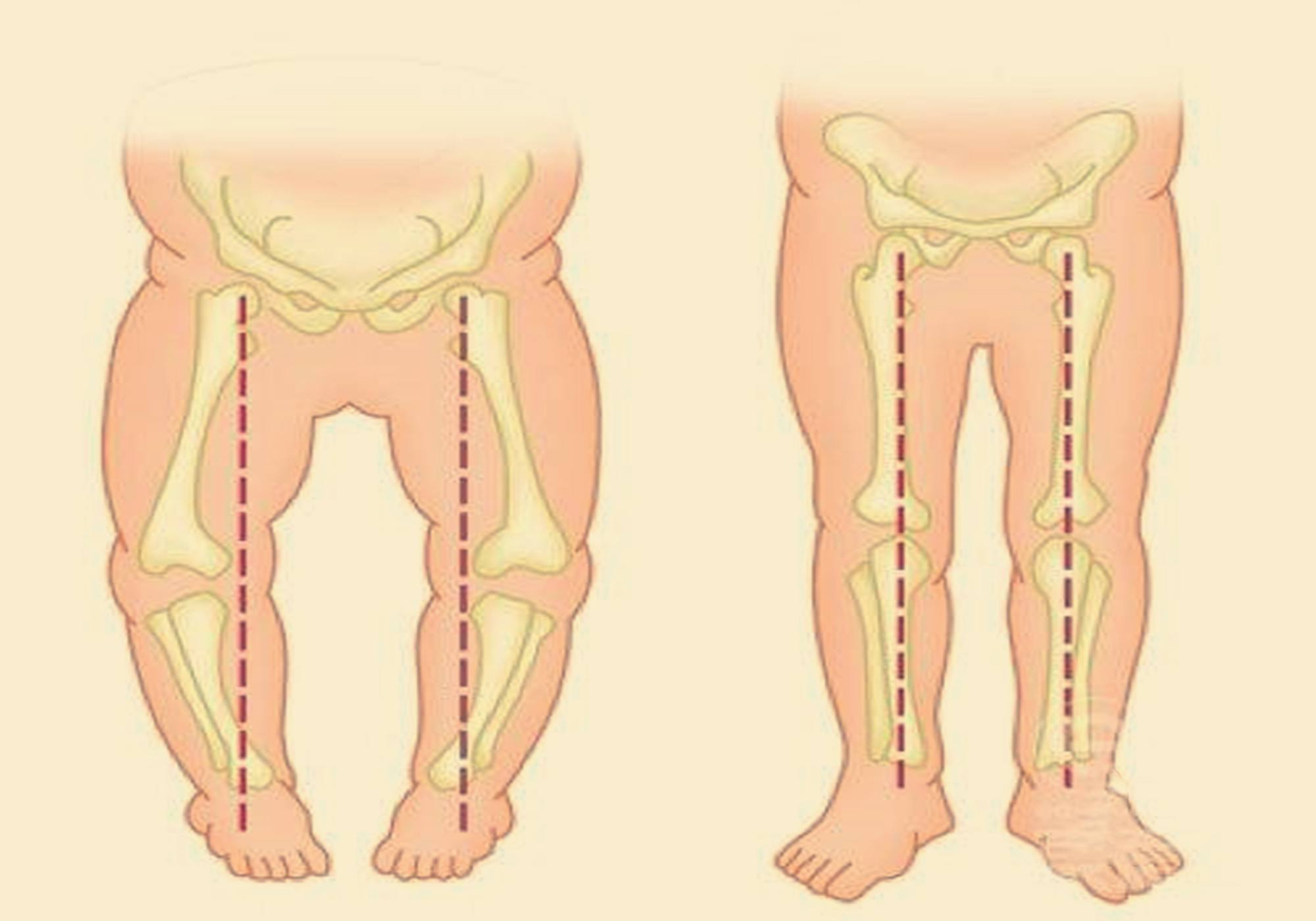 别让宝宝成为"罗圈腿",孩子的这三种错误坐姿,宝妈及时纠正