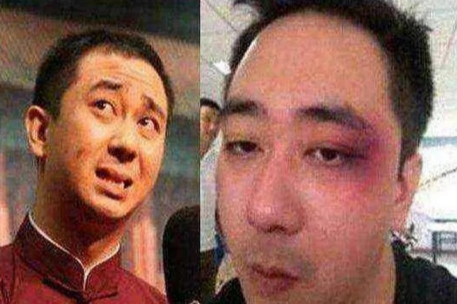 知名主持人回应抑郁传闻，曾被妻子家暴人财两空，35岁终于翻身