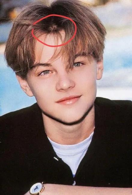 婴儿额头窄(你家娃有几个发旋) - 乐宝宝贝