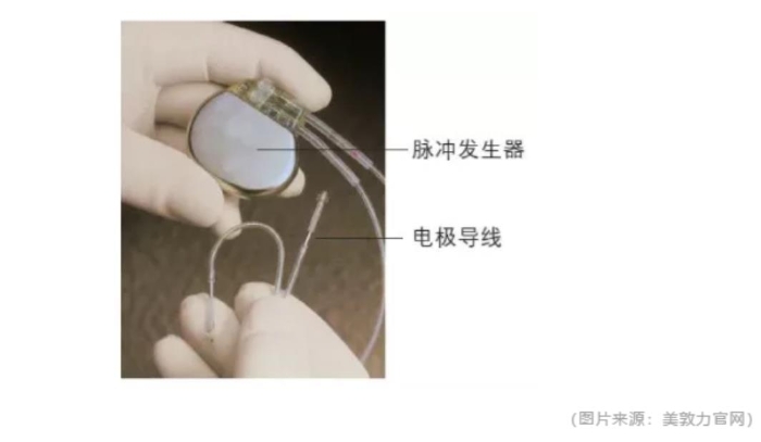 心脏备用"小马达"——心脏起搏器您了解吗?