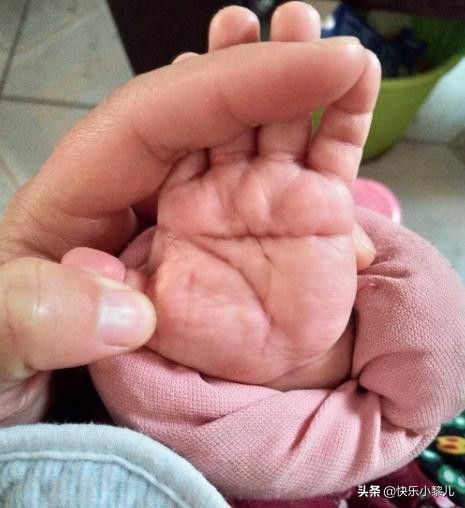 奶奶说是富贵的象征,医生的话让妈妈悔恨不已(新生儿女宝宝右手断掌)