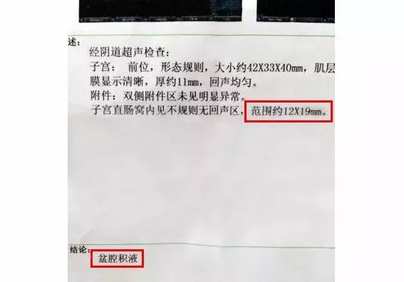 盆腔积液是妇科病吗？积液多少算严重？导致积液原因可能是这3个