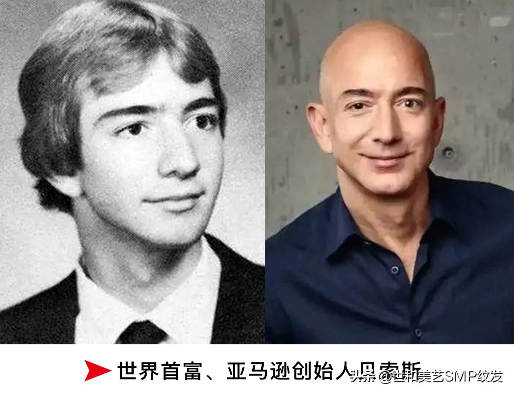 埃隆马斯克植发成功了,但秃顶的你也许更适合纹发