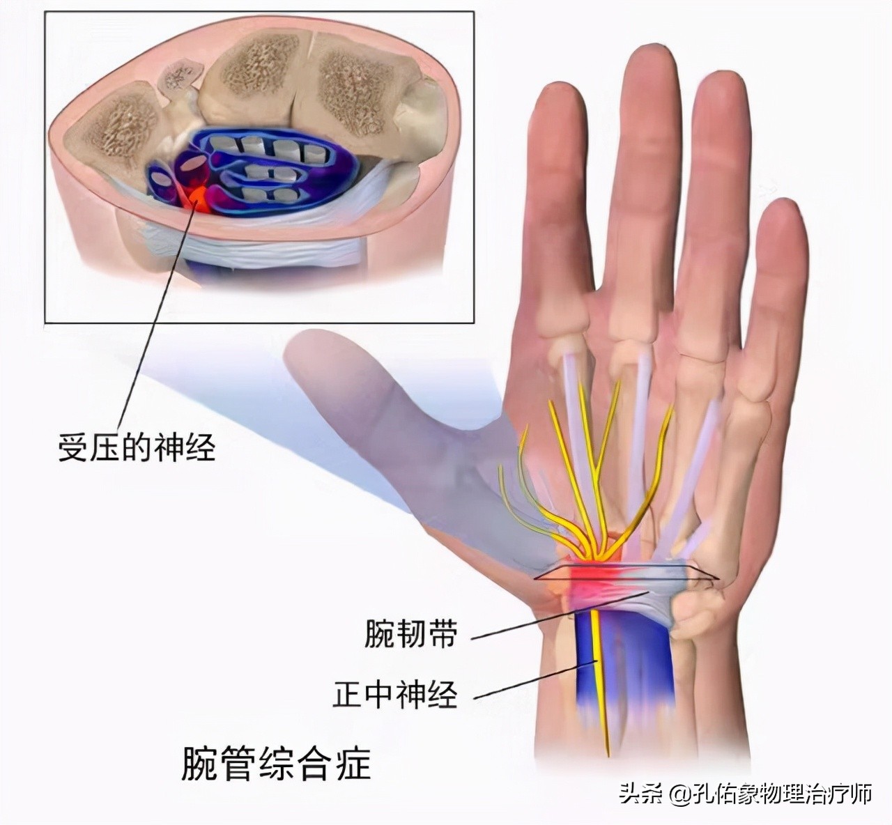 常手麻、手痛，究竟是哪里的问题？不出意外，这5种可能性最大