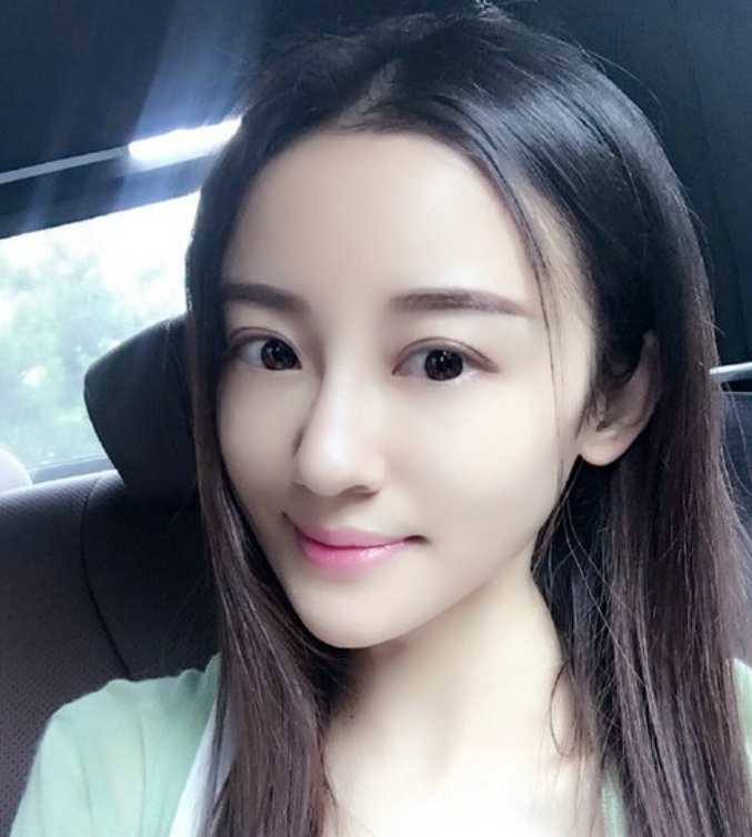 徐婷：全身溃烂医院离世，被8口家人吸血数年，死后姐姐蹭热度？