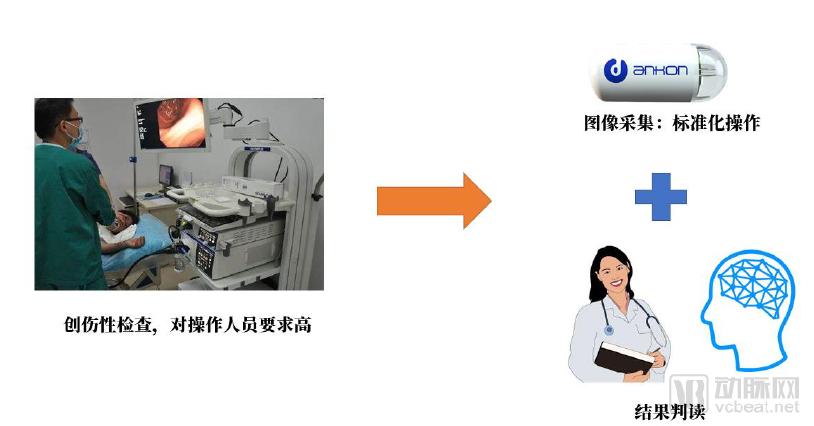 10万胶囊胃镜数据透视中国消化道健康状况，探讨器械智能化价值