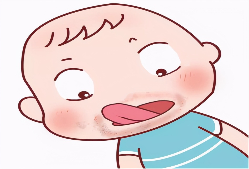 儿童口周出现淡淡的黑圈,干燥红斑,皲裂和脱屑,可能是舌舔皮炎
