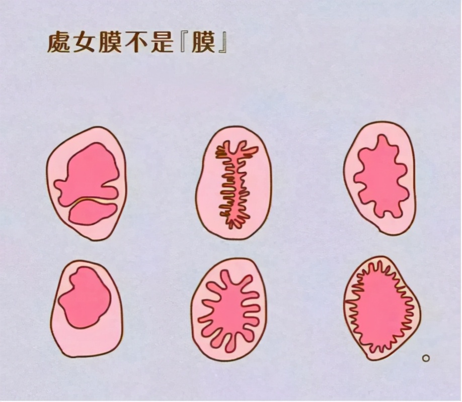 它们是长这样的:其实,处女膜是一圈环形的皱襞,并非薄如蝉翼,更不是