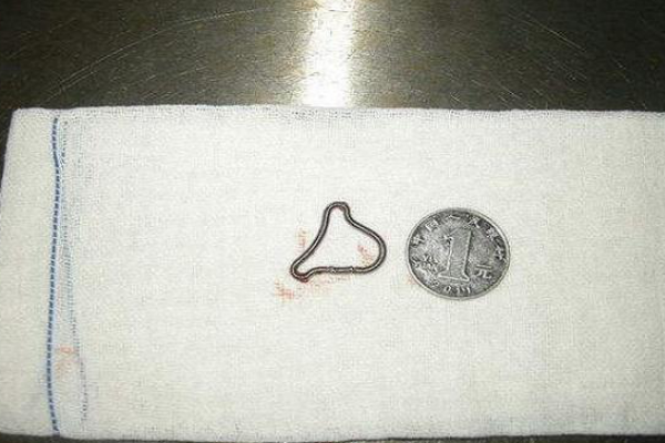 元宫环图片(三四十年后) - 赤虎壹号