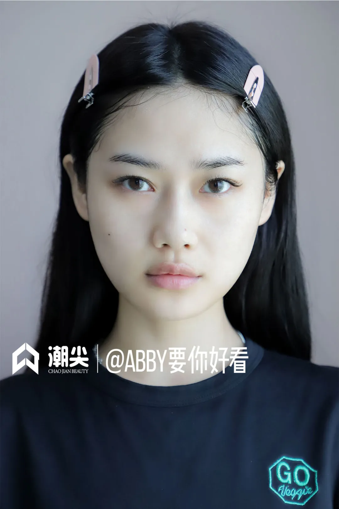 荣晟医用冷敷贴效果怎么样,好用吗