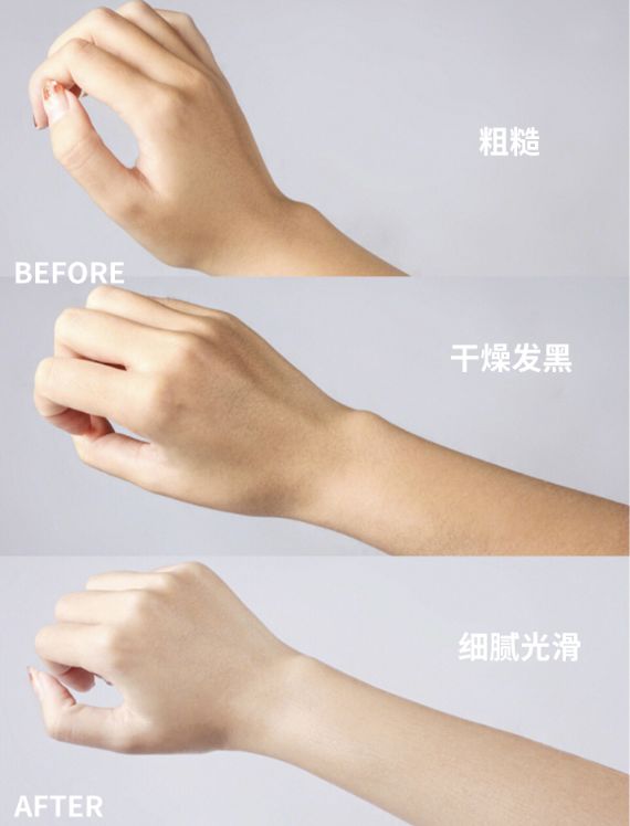 涂身体乳vs不涂身体乳，不仅皮肤差距大，原来“毛发”也跟着长