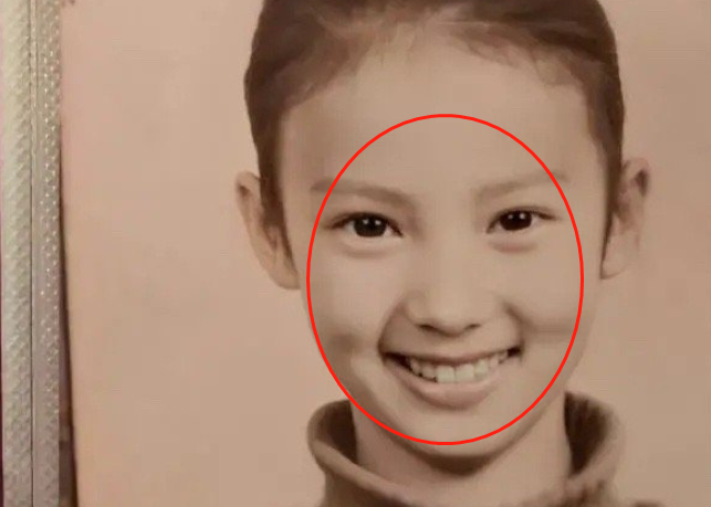 金晨鼻子被质疑动了刀子,多次辟谣整过容,却瞒不过医美工作者