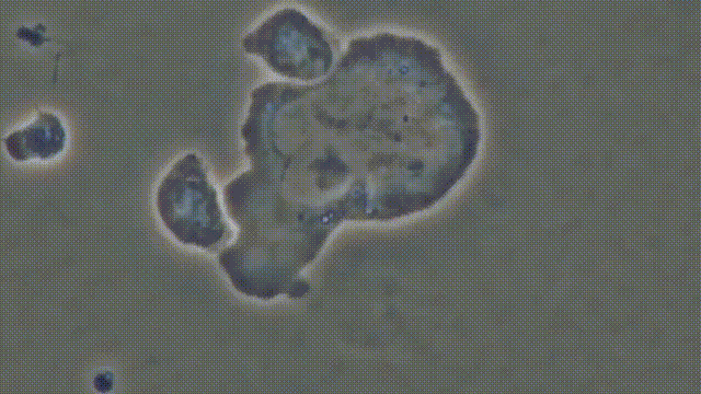 当你爆发过敏性鼻炎时，这就是你体内发生的故事