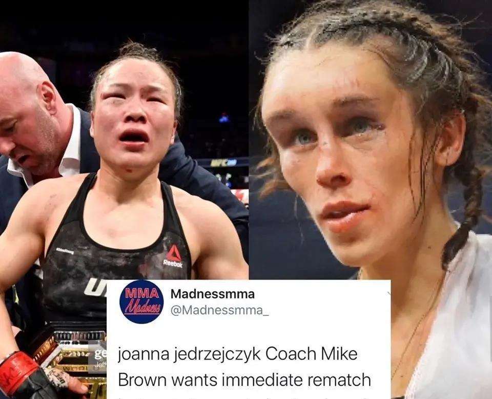 张伟丽下手太狠,把乔安娜打成外星脸,还得去整容