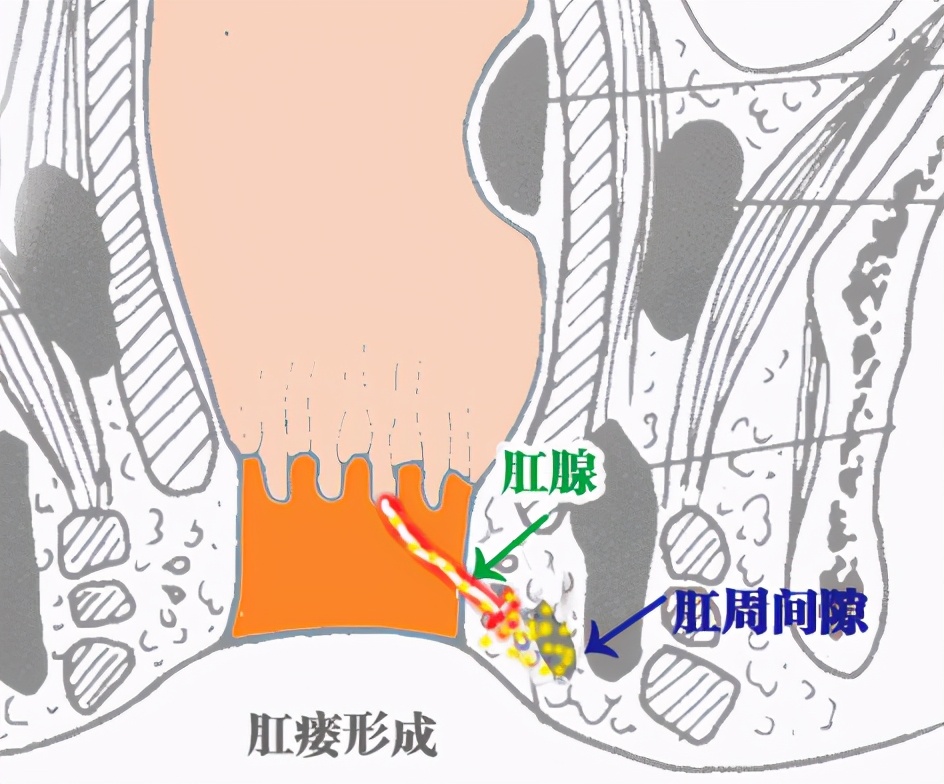 肛门解剖结构图片(菊花残) - 赤虎壹号