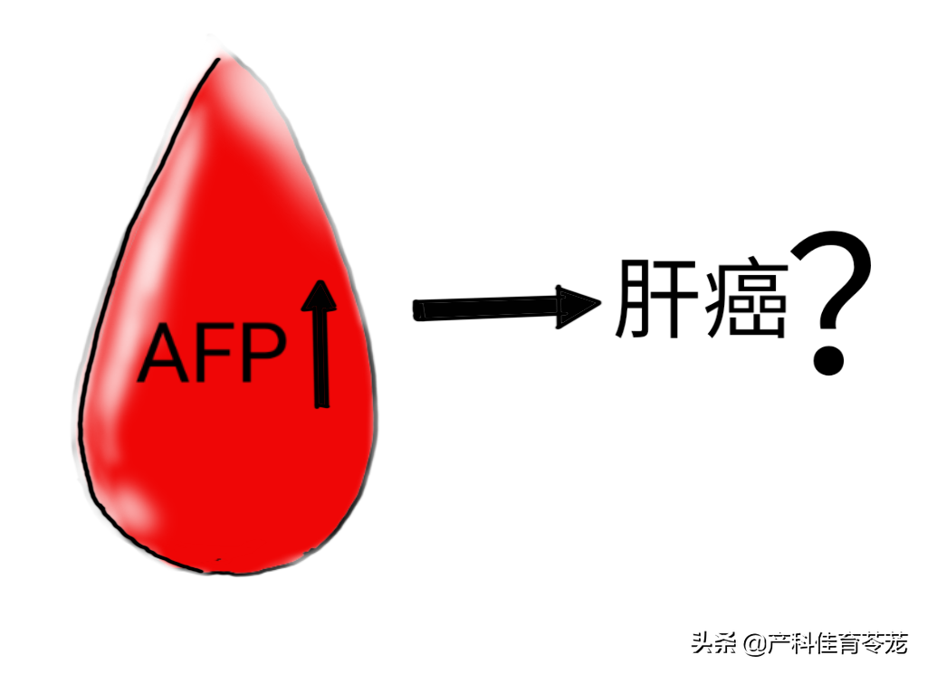 甲胎蛋白肿瘤标志物之甲胎蛋白