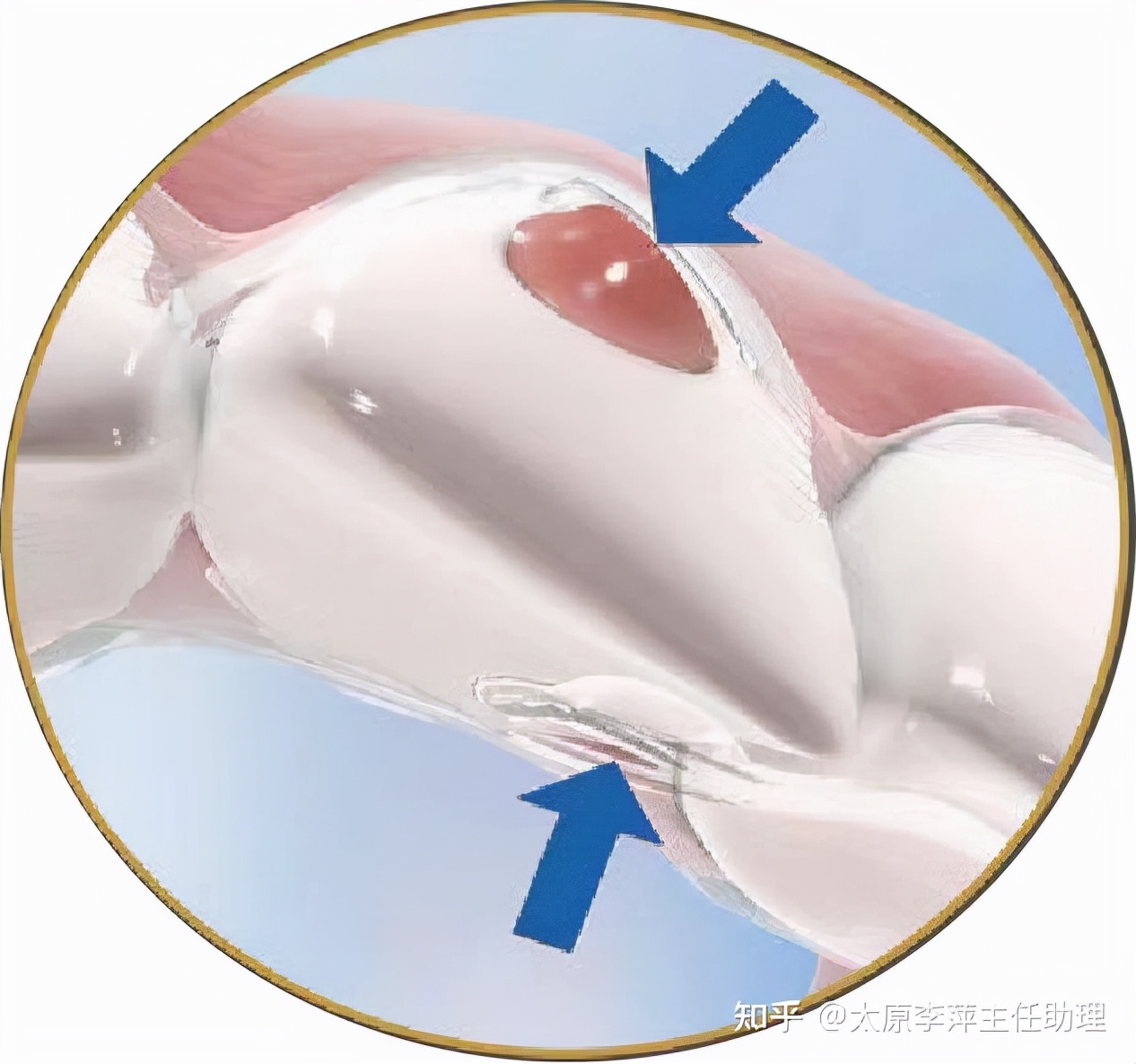 太原牙齿矫正：隐形牙套效果好不好？看这些病例你就知道了