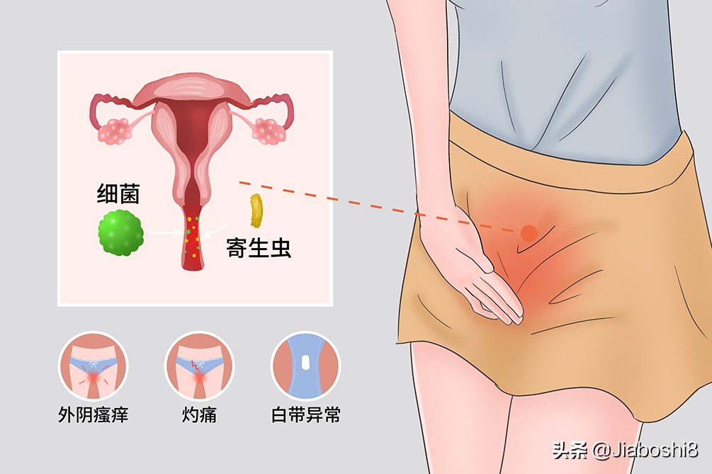 女人阳道情着图片集(女性千万不要憋尿 赤虎壹号