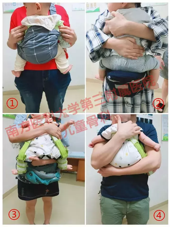 蛙式支架多少钱(发育性髋关节脱位致残率高) - 价格百科