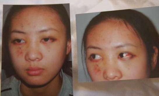 云南女明星：被男友暴打住院，遭老师侮辱，嫁15家公司老板后走红