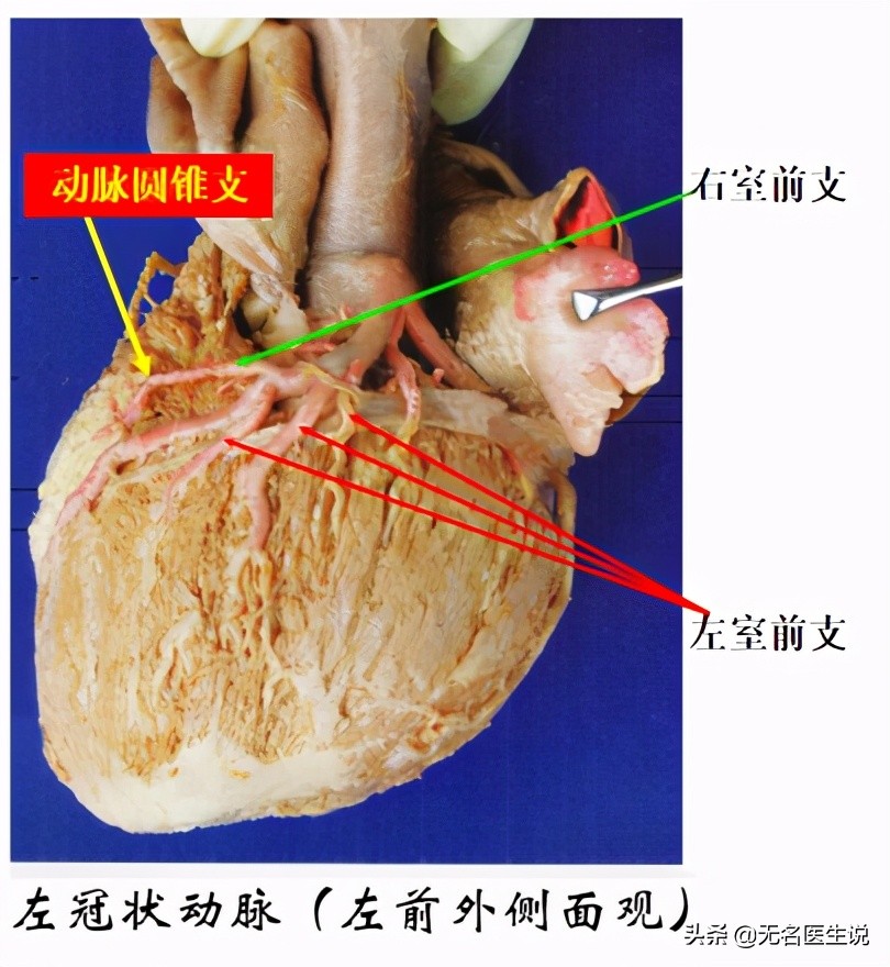 心收縮時,冠狀動脈心肌內支受壓迫,因而影響冠狀動脈的血流.