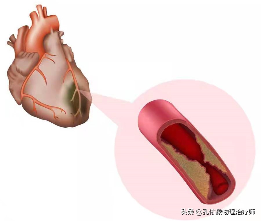 肩膀疼痛是怎么回事？本文告知您9种病因，让您再也不盲目咨询