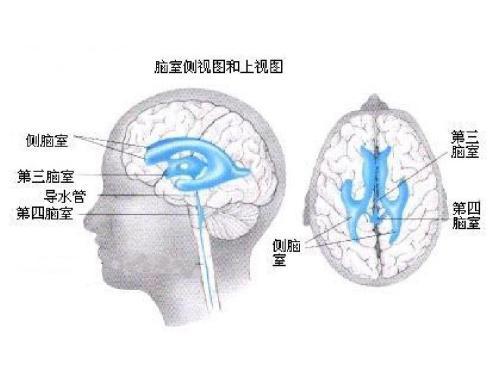 脑梗塞“开刀”做外科手术就能好？听听脑科医生怎么说