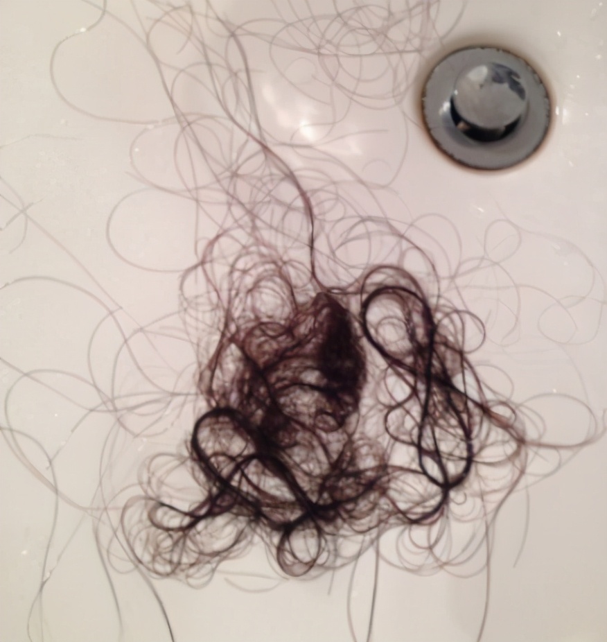 产后掉头发,一抓一把,5个问题了解产后脱发,教新妈妈如何预防