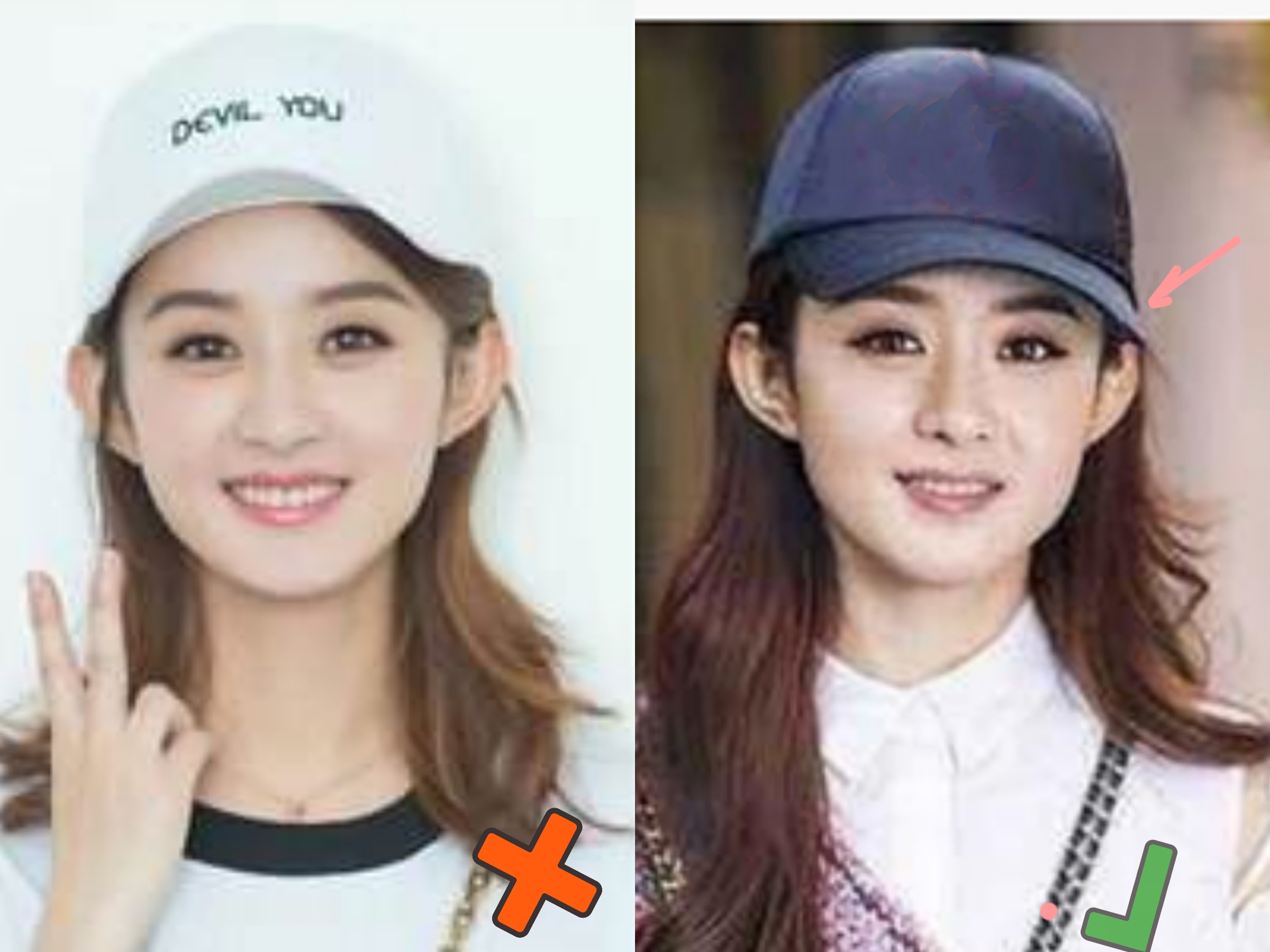 &quot（头大怎么办）