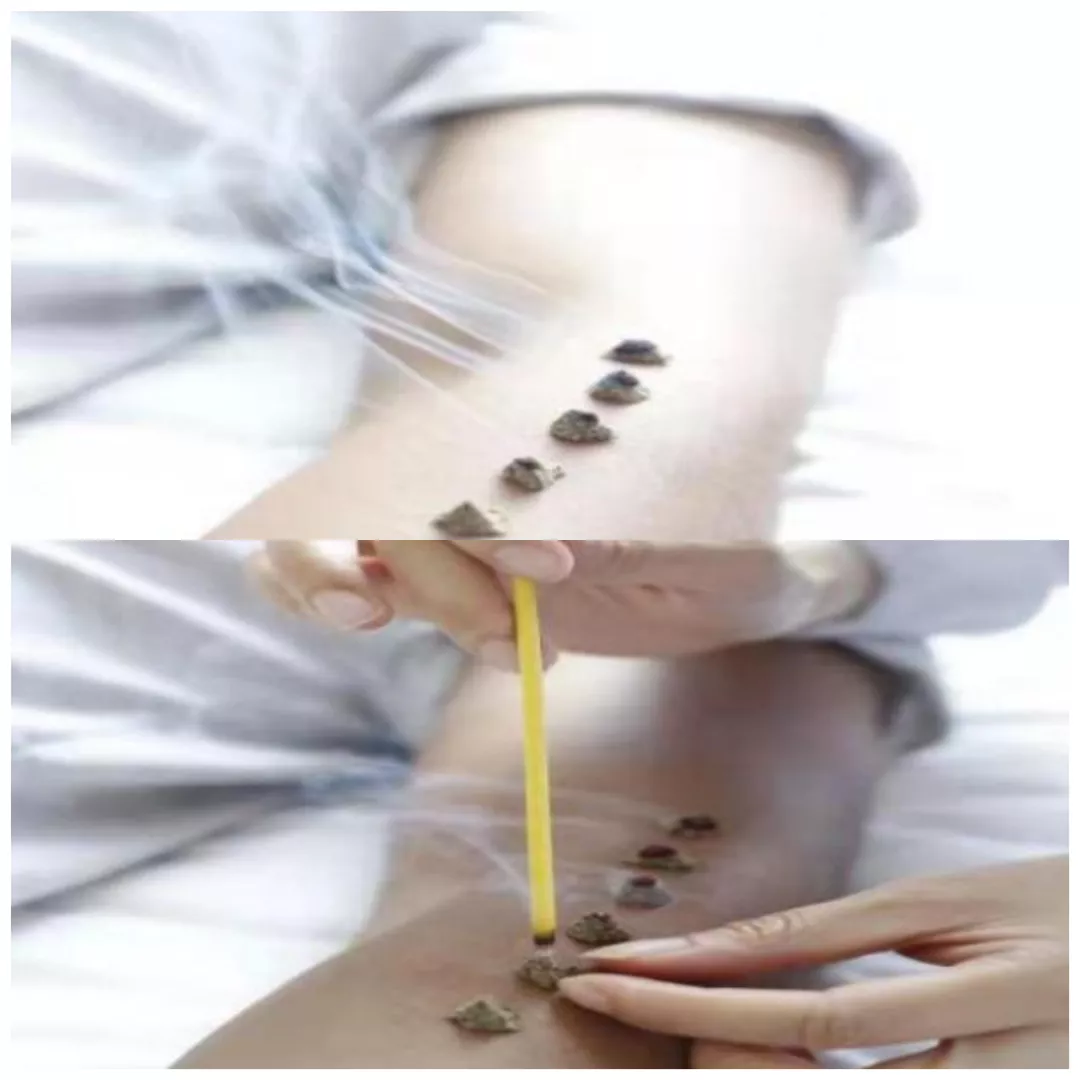 过敏性鼻炎高发季,治疗指南快收藏