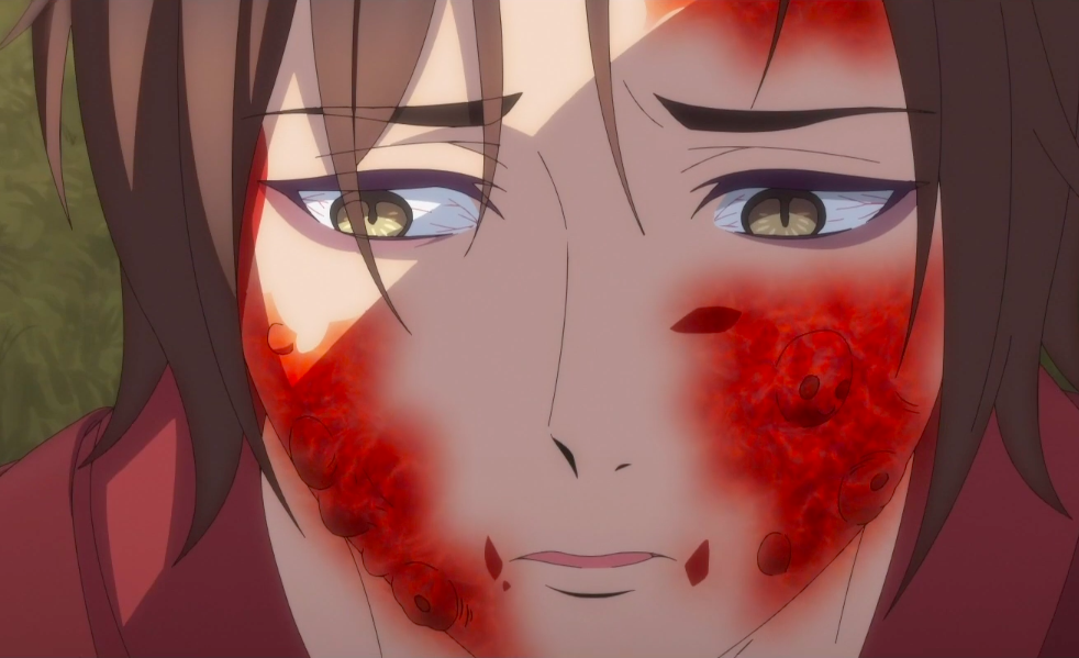 人面疫(人面疫是什么东西)