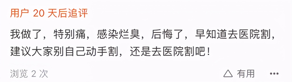 “割包皮”风气兴起，儿科患者排队做手术，医生：割包皮割到想吐