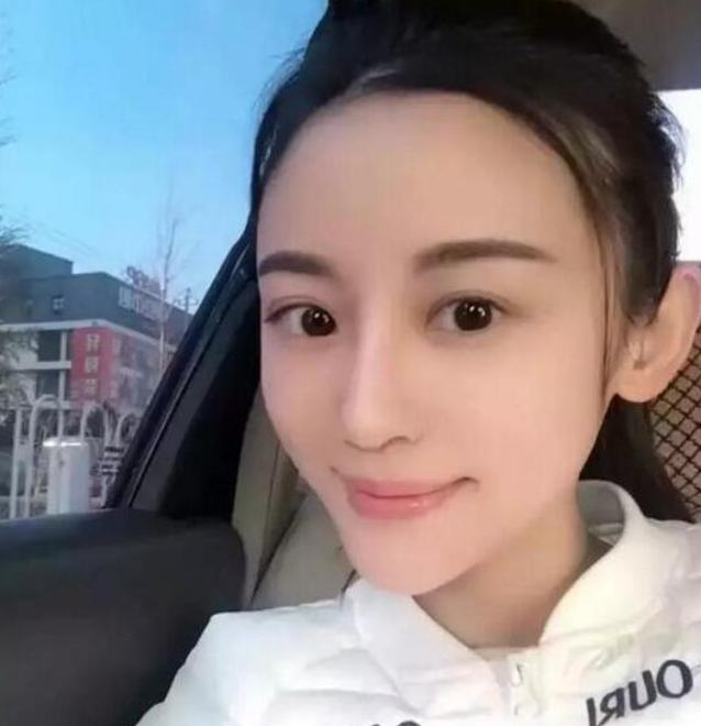 徐婷：全身溃烂医院离世，被8口家人吸血数年，死后姐姐蹭热度？