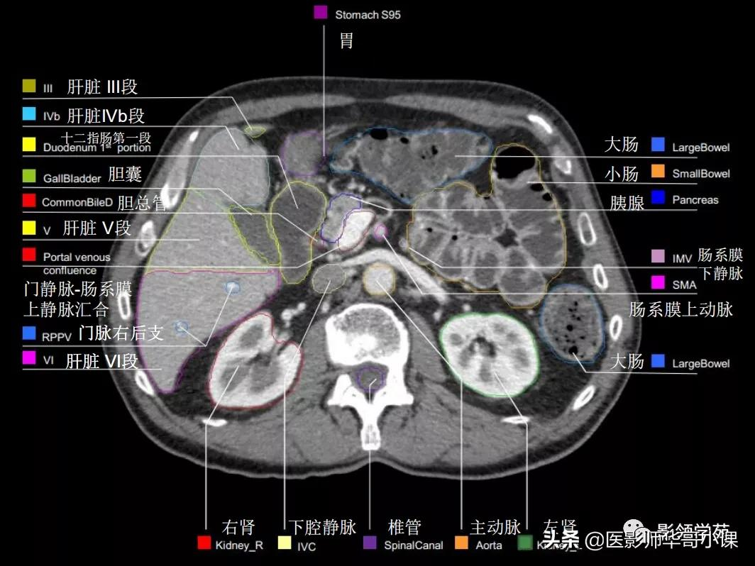 肝ct分段解剖示意图图片