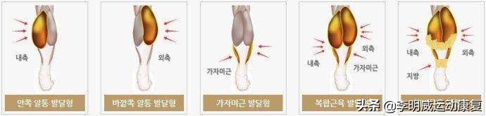 如何有效瘦小腿？